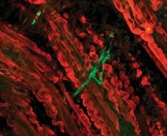 Myosin Heavy Chain Antibody MAB4470
