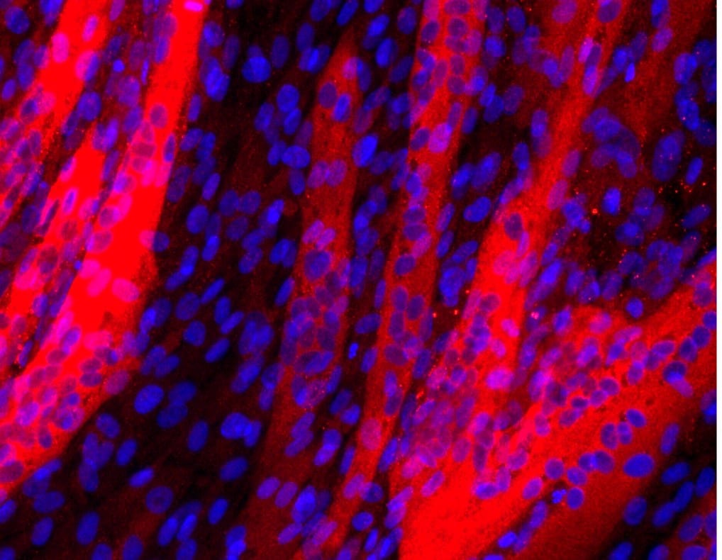 Myosin Heavy Chain Antibody MAB4470