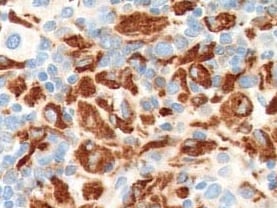 Human Apolipoprotein C‑II/ApoC2 Antibody MAB44971