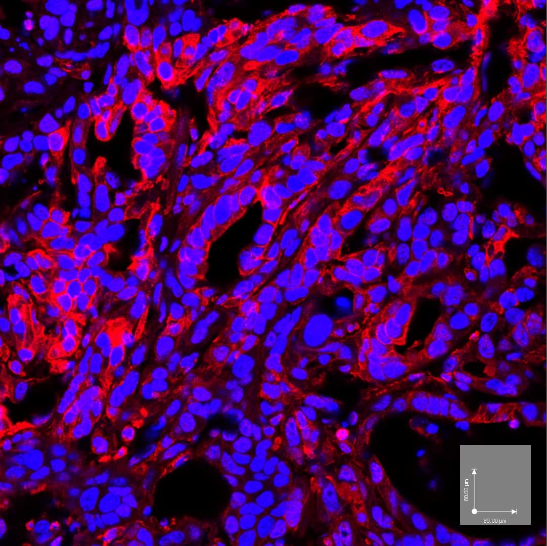 Human Phospho-FAK (Y397) Antibody MAB4528