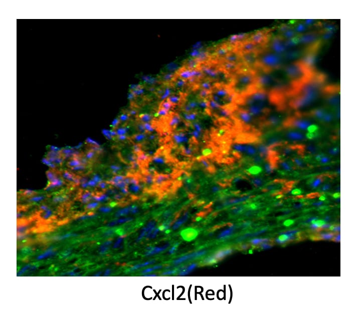 Mouse CXCL2/GRO beta /MIP‑2/CINC‑3 Antibody MAB452