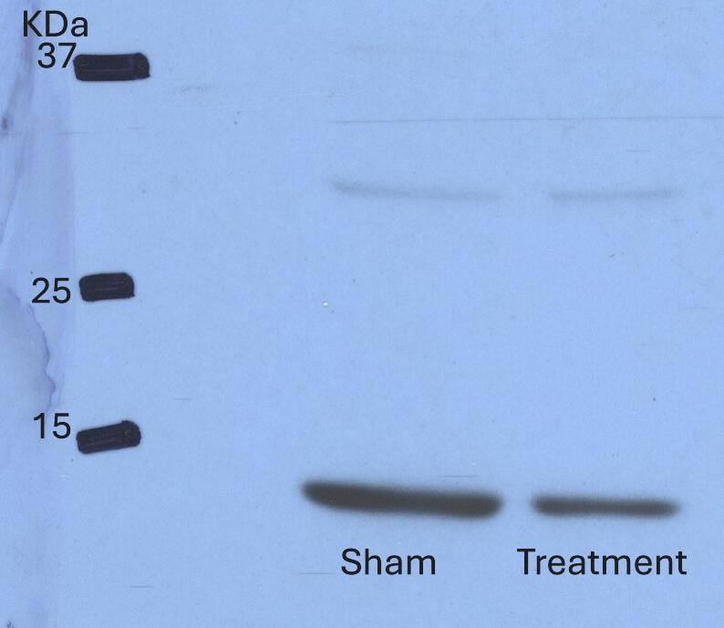 Mouse CXCL2/GRO beta /MIP‑2/CINC‑3 Antibody MAB452