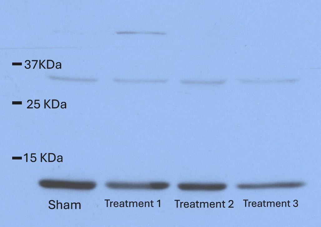 Mouse CXCL1/GRO alpha /KC/CINC‑1 Antibody MAB453