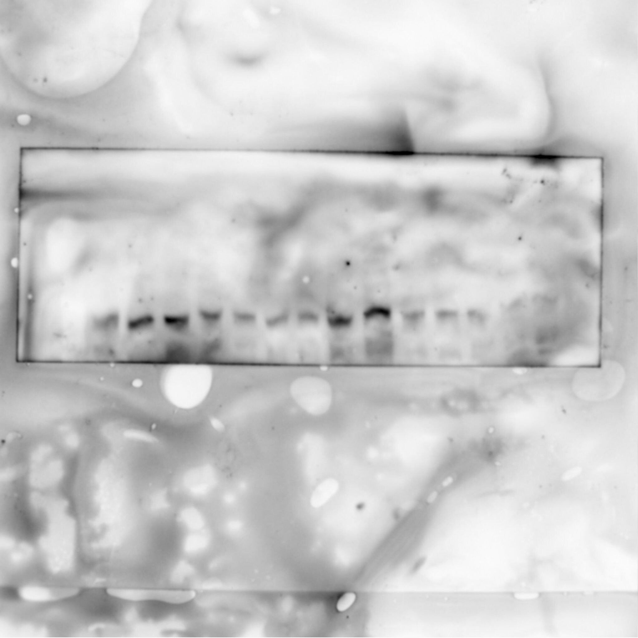 Human/Mouse/Rat Raf‑1 Antibody MAB4540