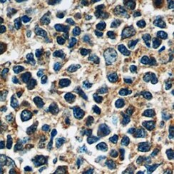 Human beta-Arrestin 1 Antibody MAB45601