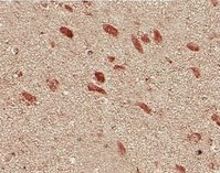 Human S100A8/S100A9 Heterodimer Antibody MAB45701