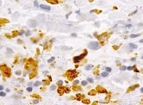 Human S100A8 Antibody MAB4570