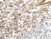 Mouse CCL21/6Ckine Antibody MAB457