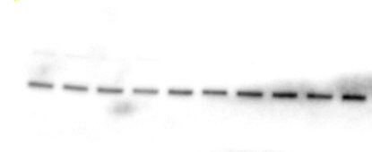 Human/Mouse/Rat ROCK1 Antibody MAB4590