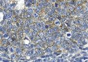 Human CD81 MAb (Clone 454729) MAB46151