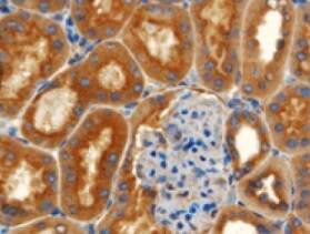 Human NAALADase‑like 2/NAALADL2 Antibody MAB46651