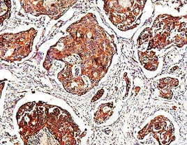 Human/Rat PAK7 Antibody MAB4696