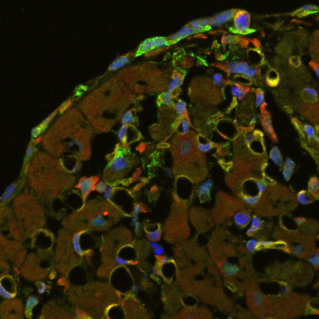 Mouse VEGFR1/Flt-1 Antibody MAB471