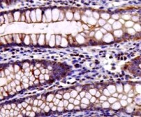 Human Neuromedin BR/NMBR Antibody MAB47281