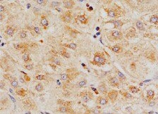 Human Hepsin Antibody MAB47761