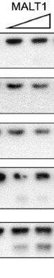 Human MALT1 Antibody MAB4850