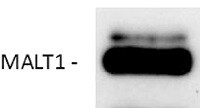 Human MALT1 Antibody MAB4850