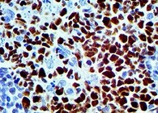 Human Secretagogin Antibody MAB4878