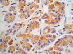 Human Reg1A/B Antibody MAB49371