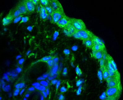 Mouse Oncostatin M/OSM Antibody MAB4951