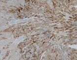 Mouse Angiopoietin‑like Protein 7/ANGPTL7 Antibody MAB4960