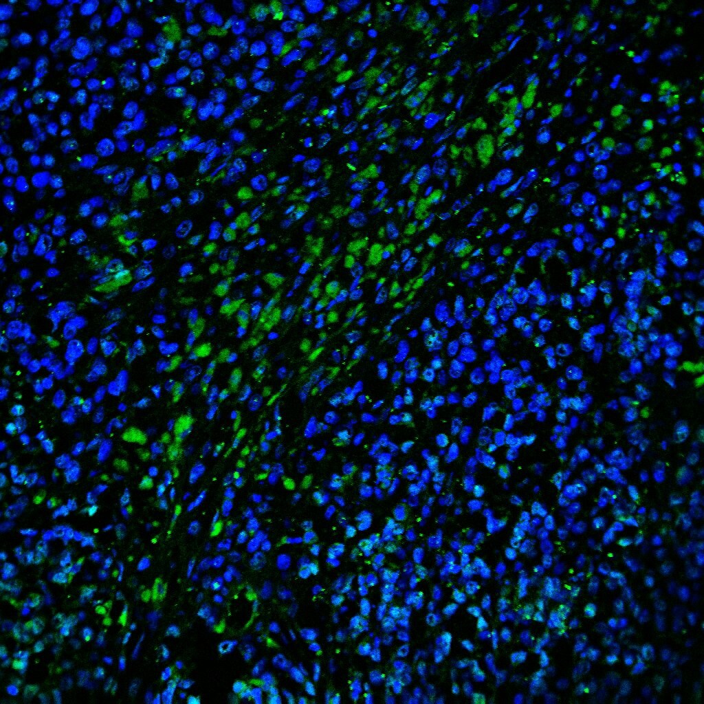 Mouse IL‑12/IL‑23 p40 Antibody MAB4991