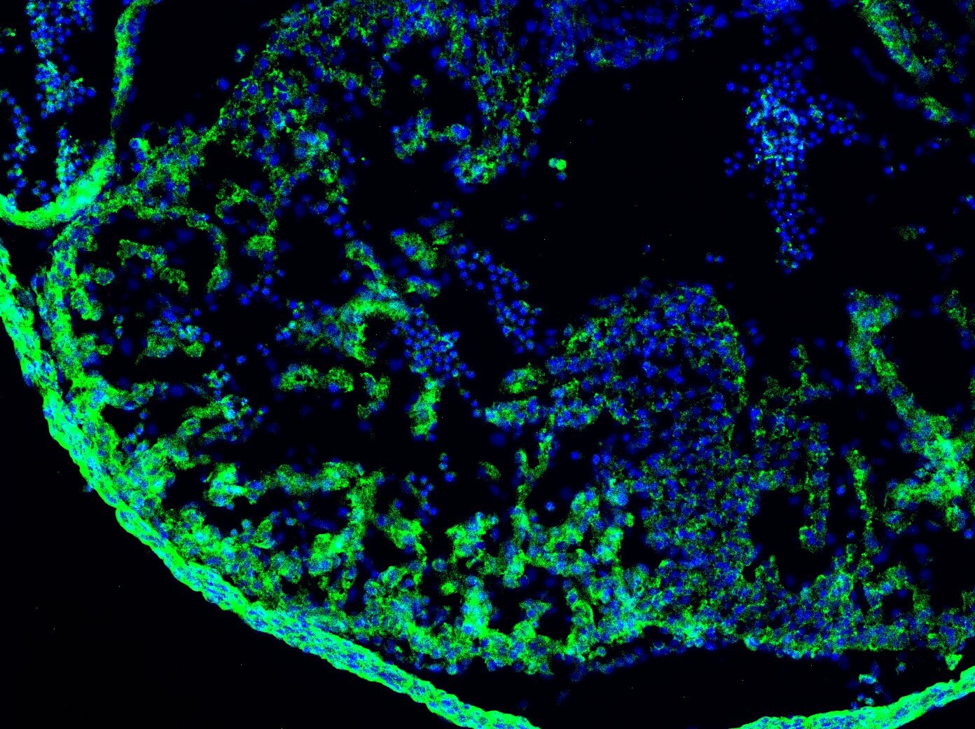 Mouse BMP‑4 Antibody MAB5020