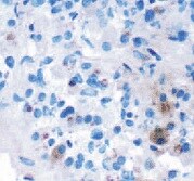 Mouse BMP‑4 Antibody MAB5020