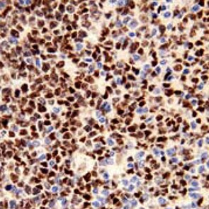 Human IRF8 Antibody MAB5117