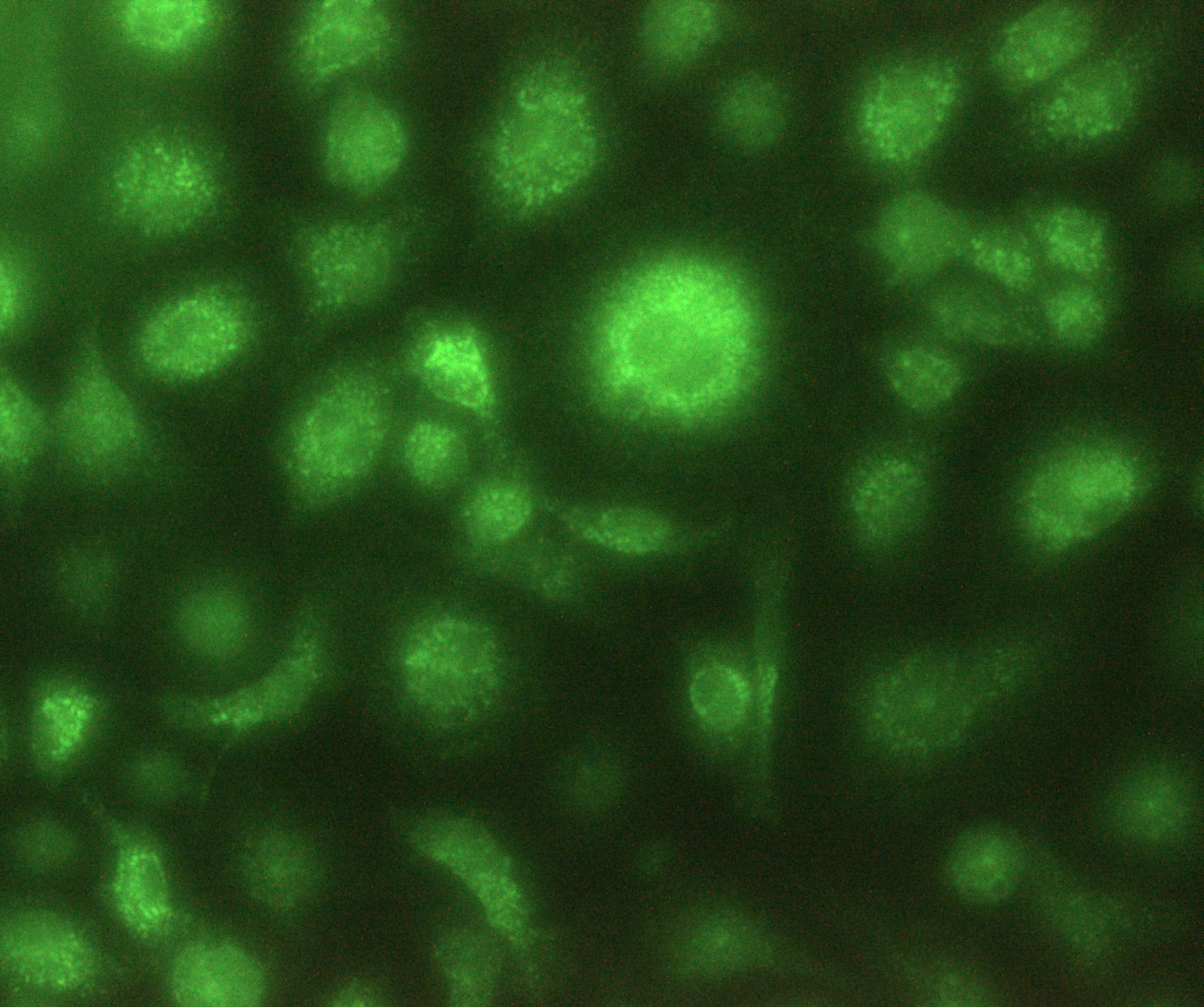 Human MMP‑13 Antibody MAB511