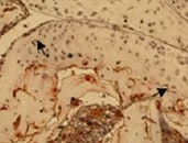 Human MMP‑13 Antibody MAB511