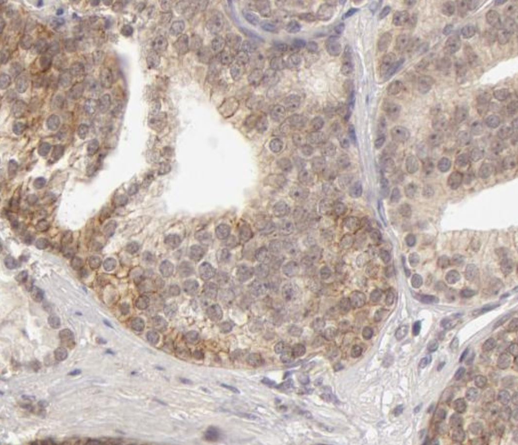 Human MMP‑13 Antibody MAB511