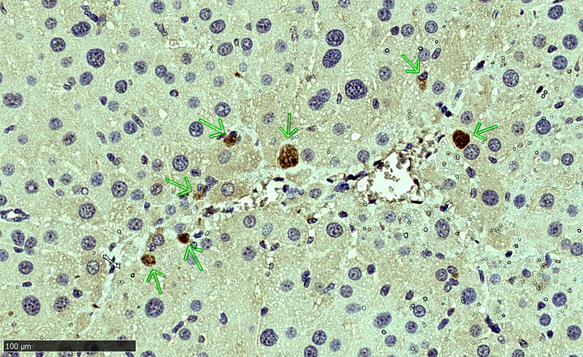Human MMP‑13 Antibody MAB511