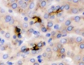 Human ADAMTS15 Antibody MAB5149
