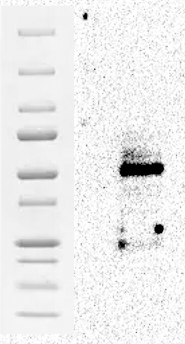 Human Enolase 2/Neuron‑specific Enolase Antibody MAB5169