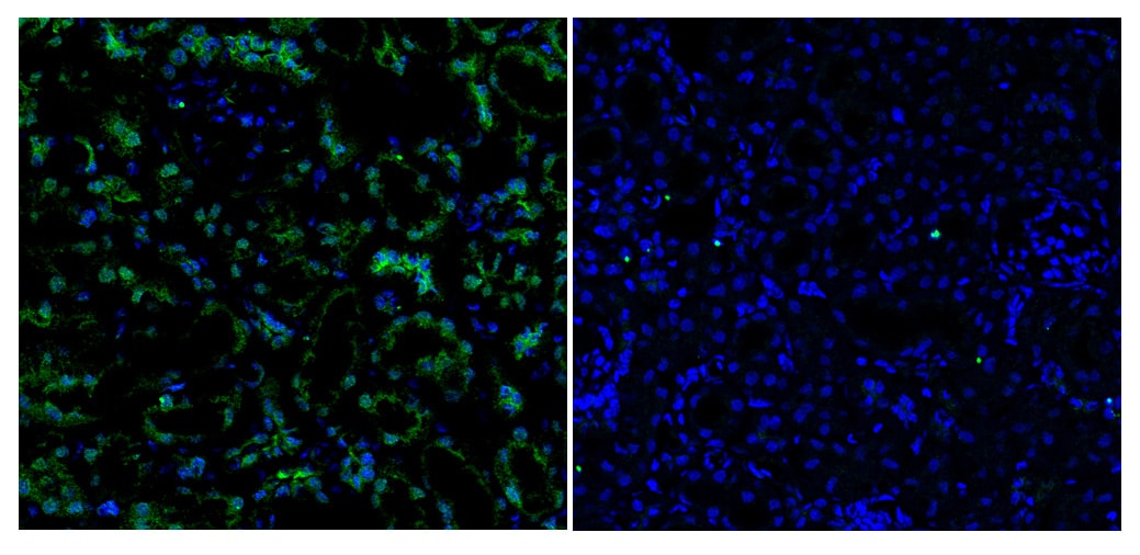 Mouse Pro EGF Antibody MAB5256