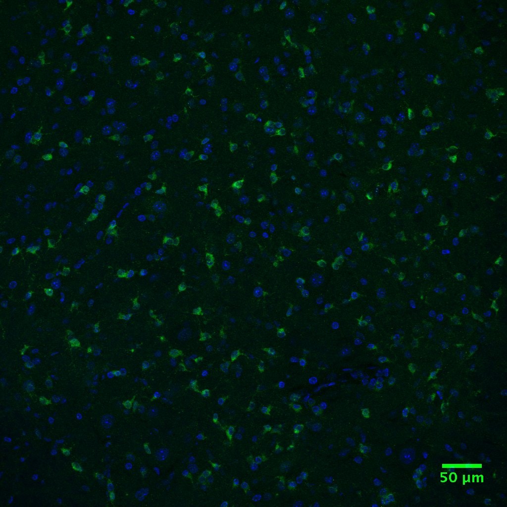 Mouse TGF‑ beta  RII Antibody MAB532