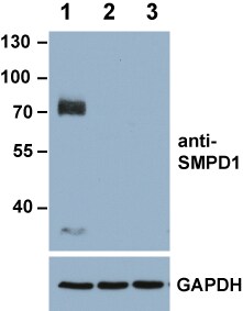 Human SMPD1 Antibody MAB5348