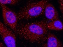 Human Nicastrin Antibody MAB5378