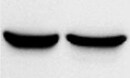 Human/Rat DYRK2 Antibody MAB5408