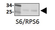 Human/Mouse/Rat Ribosomal Protein S6/RPS6 Antibody MAB5436