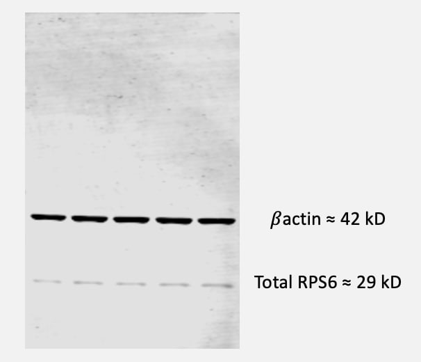 Human/Mouse/Rat Ribosomal Protein S6/RPS6 Antibody MAB5436