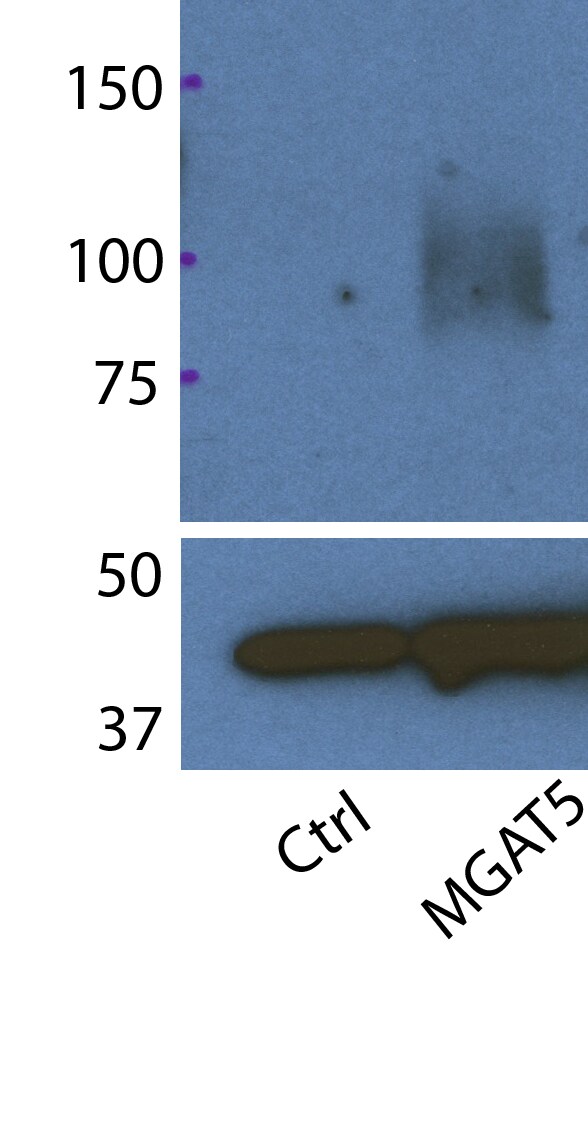 Human N‑Acetylglucosaminyltransferase V/MGAT5 Antibody MAB5469