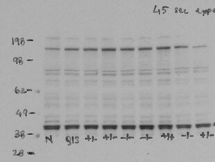 Mouse MMP‑3 Antibody MAB548