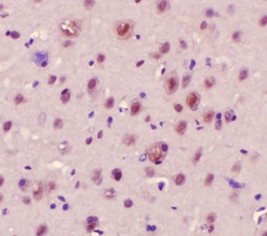 Human  beta -Synuclein Antibody MAB5528