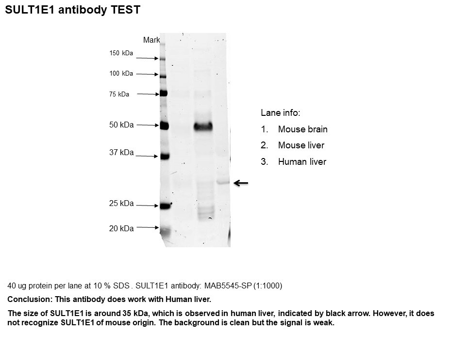 Human Cytosolic Sulfotransferase 1E1/SULT1E1 Antibody MAB5545