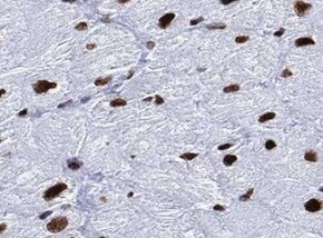Human PP2C gamma  Antibody MAB5595
