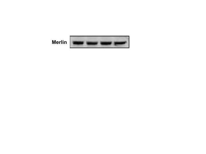 Human NF2/Merlin Antibody MAB5616