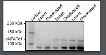 Human Phospho-NFATC1 (S172) Antibody MAB5640