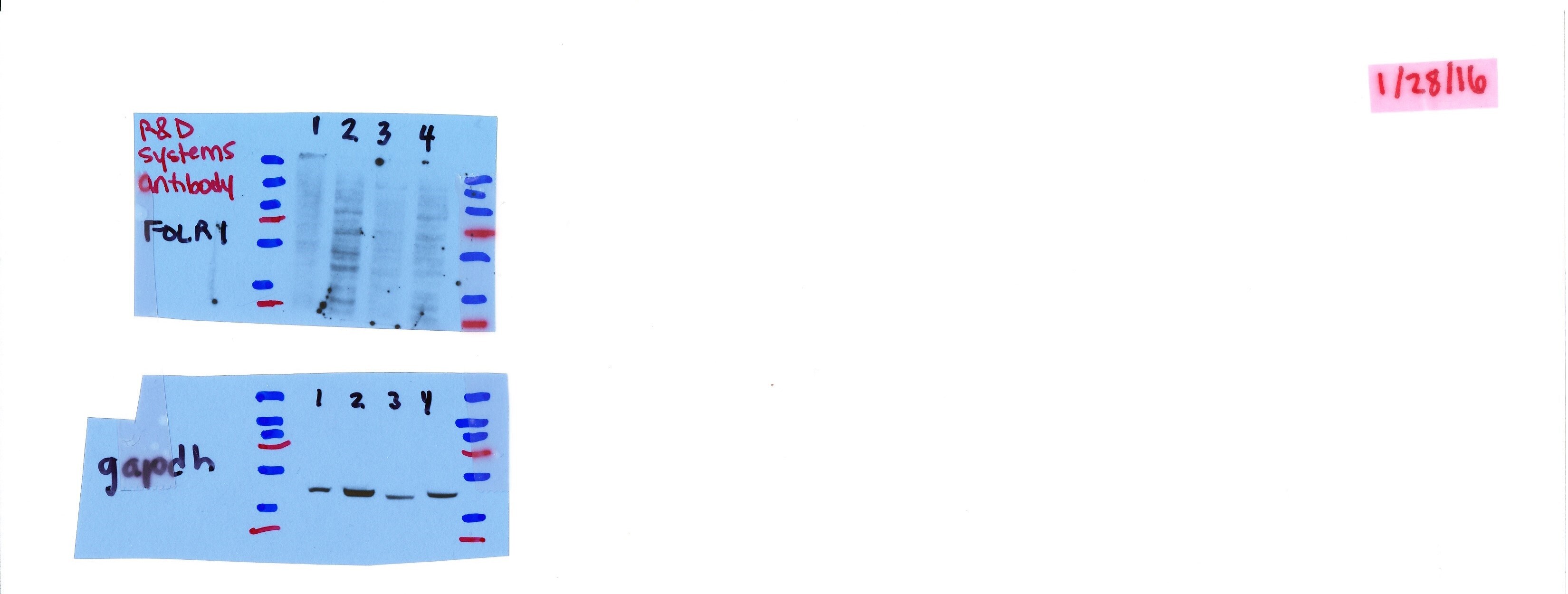 Human FOLR1 Antibody MAB5646